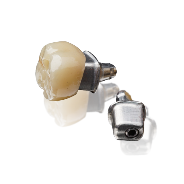 Implantataufbau- individuelles, gefrästes Abutment in Titan